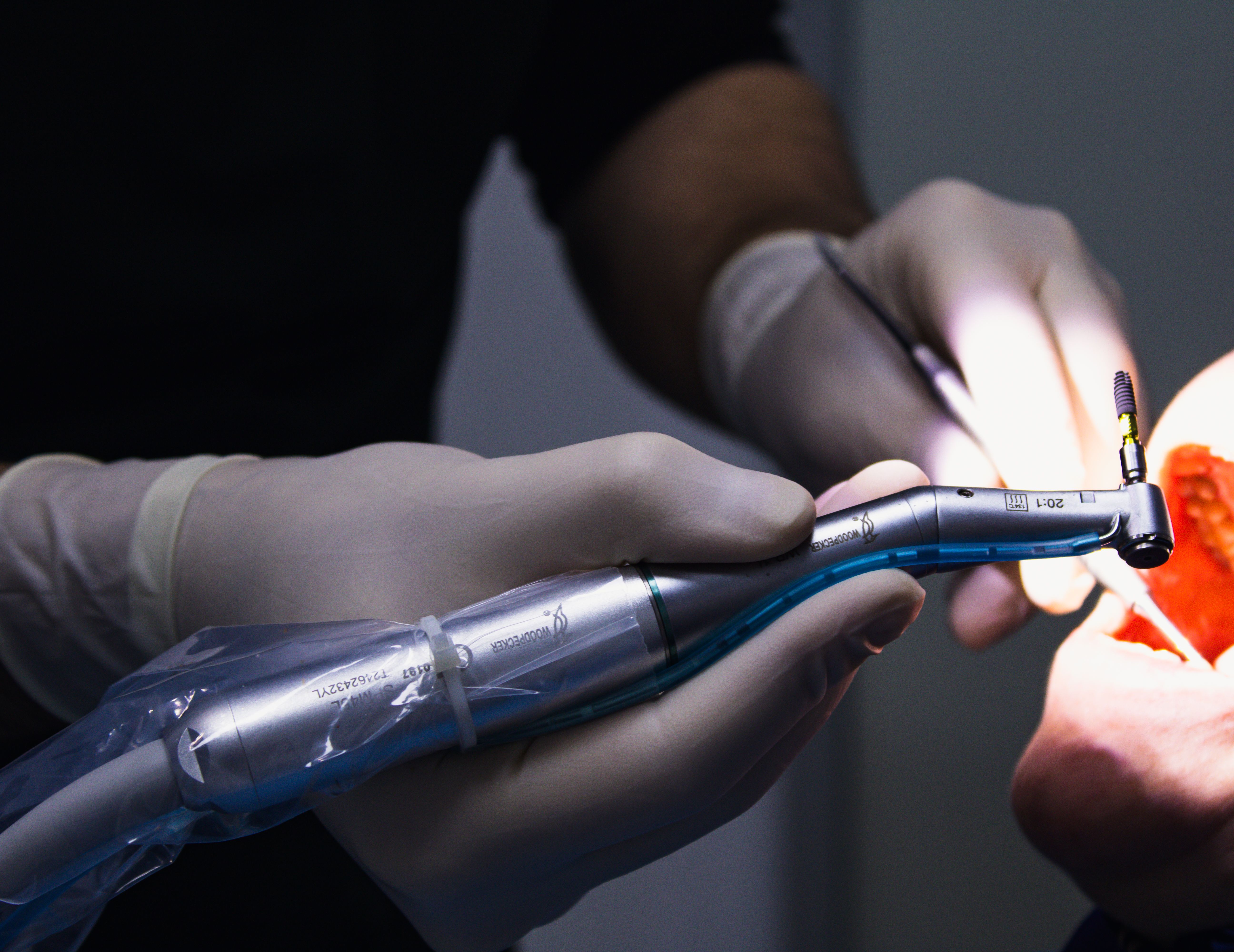 Root Canal Therapy